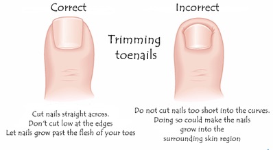 Picture of correct way to trim toenails