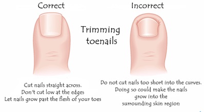 How to Trim Thick Toenails: Step-By-Step - Fix Ugly Nails