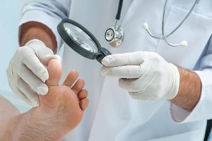 Causes of Toenail Fungus - Fungus