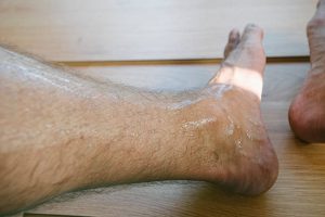 Risk Factors for Toenail Fungus - Sweating