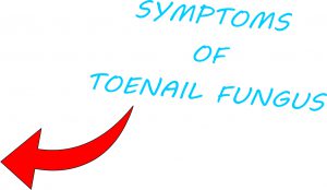 PICTURE TO LOOK AT THE SYMPTOMS OF TOENAIL FUNGUS