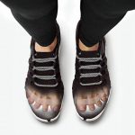 PICTURE OF AWESOME TOES WORN WITH SHOES FOR POST TOE SEPARATORS FOR OVERLAPPING TOES