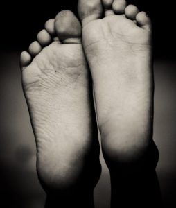 PICTURE OF FEET FOR POST FIBROMYALGIA AND FOOT PAIN